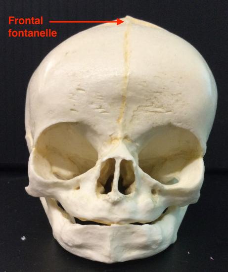 Fetal Skull Anterior View