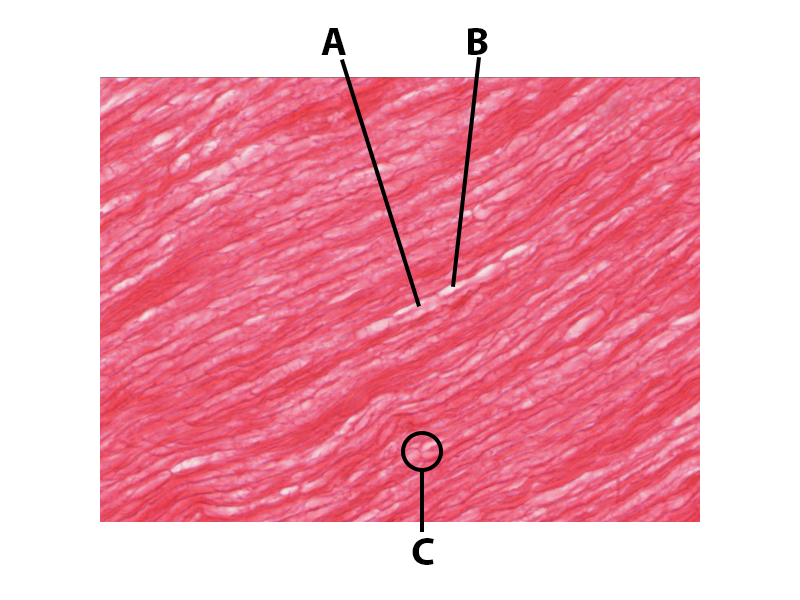 nerve histology long section.png