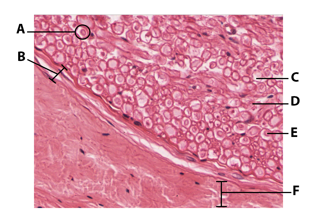 nerve histology cross section 400x.png