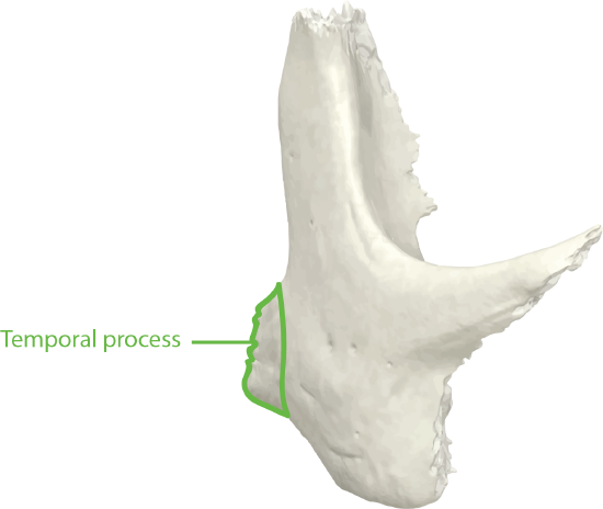 Zygomatic Bone Anterior View with Temporal Process