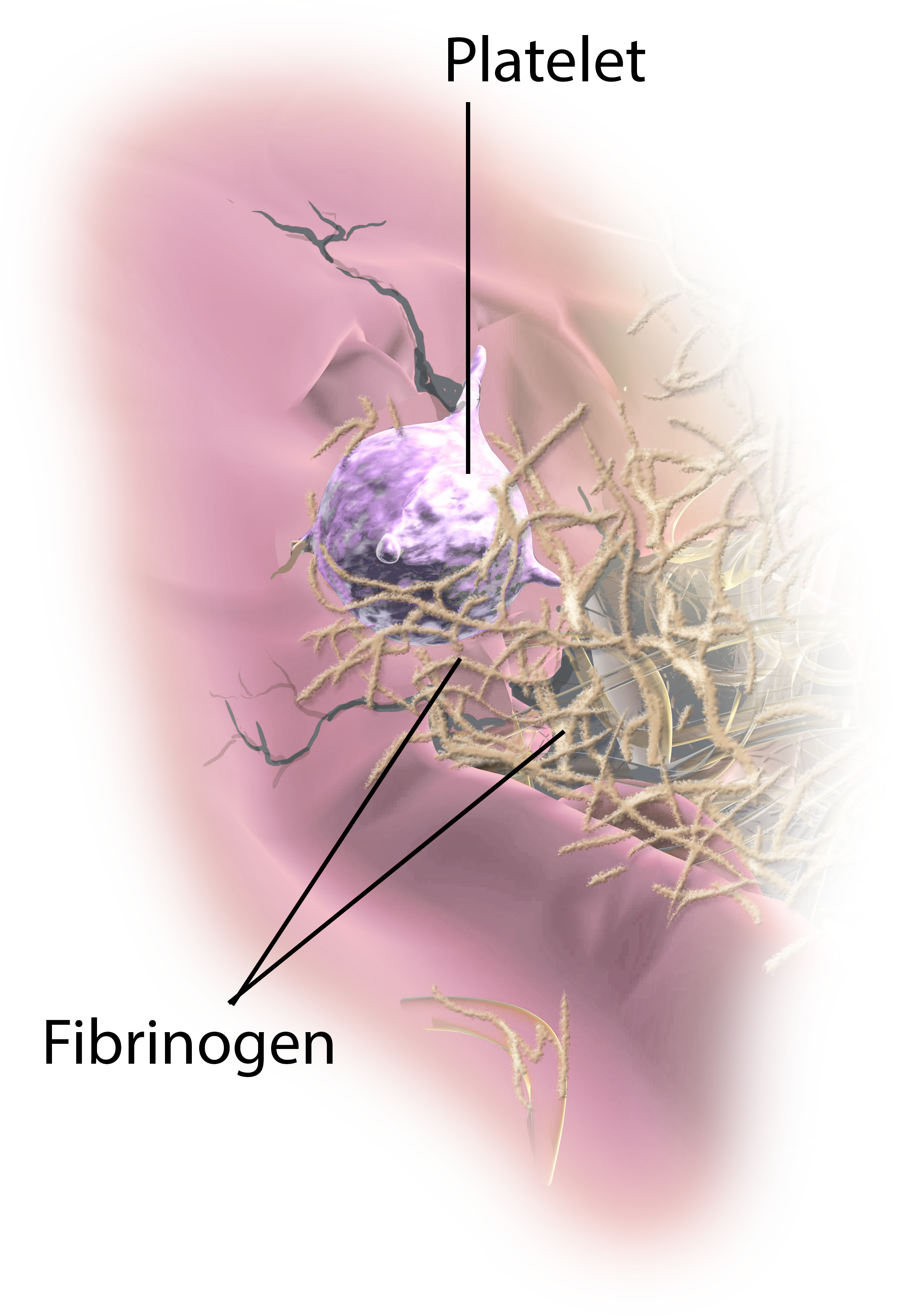 Fibrinogen and Platelet Clot.png