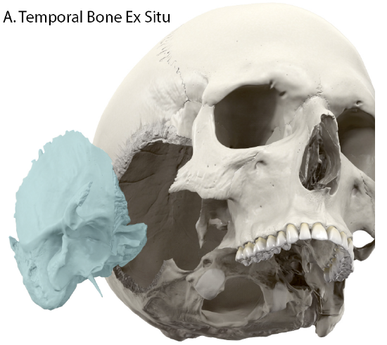 Temporal Bone Ex Situ
