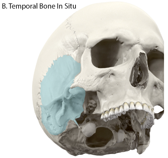 Temporal Bone In Situ