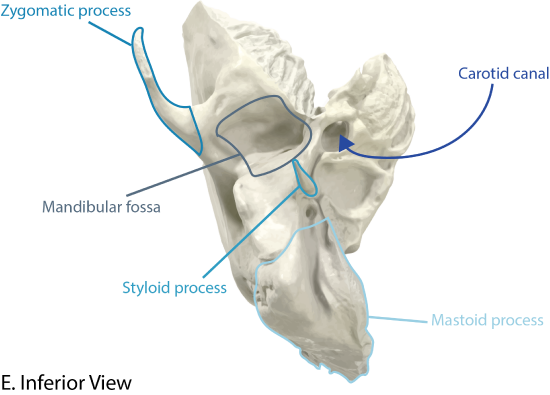 Temporal Bone Inferior View with Landmarks Labeled.png