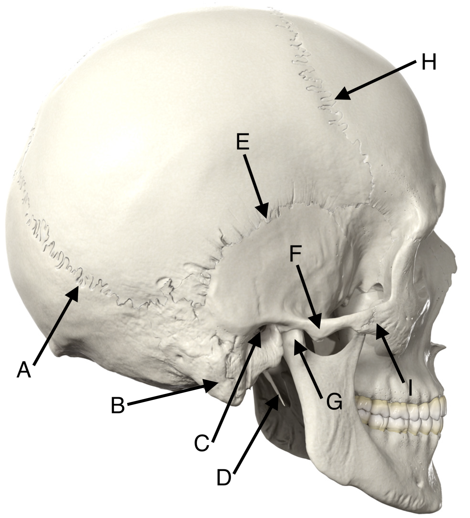 Skull Posterolateral View with Landmarks Lettered.png