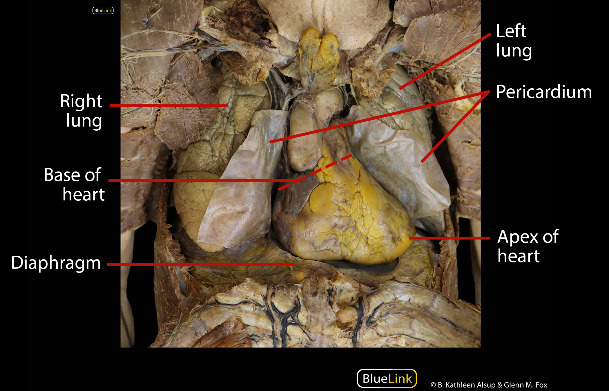Position of the Heart - Cadaver.png