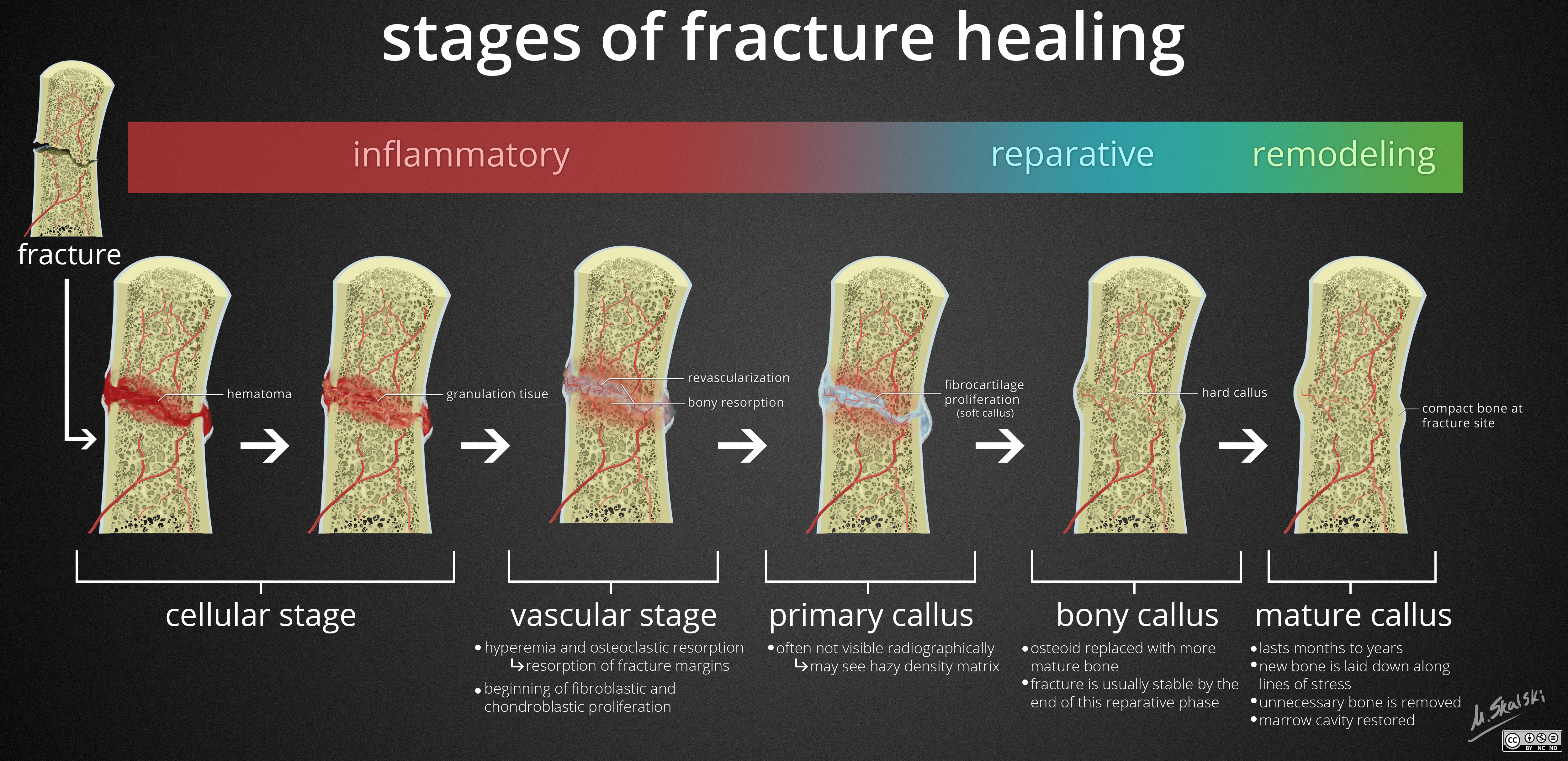 fracture-healing-diagrams.jpg