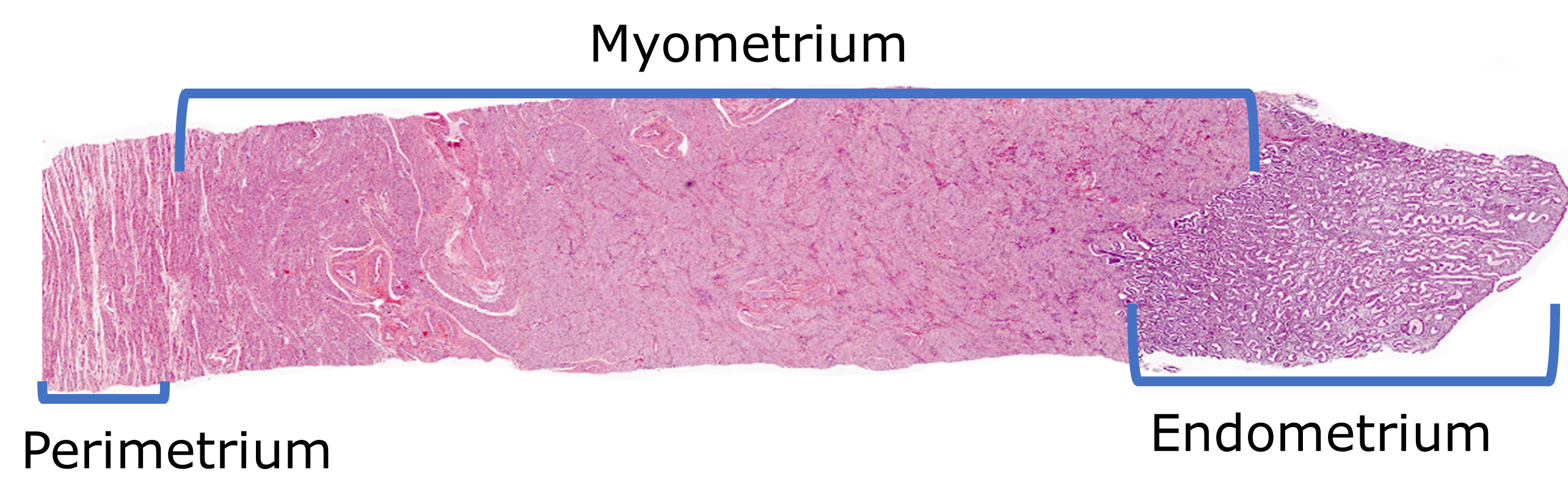 Cross section view of wall of the uterus.