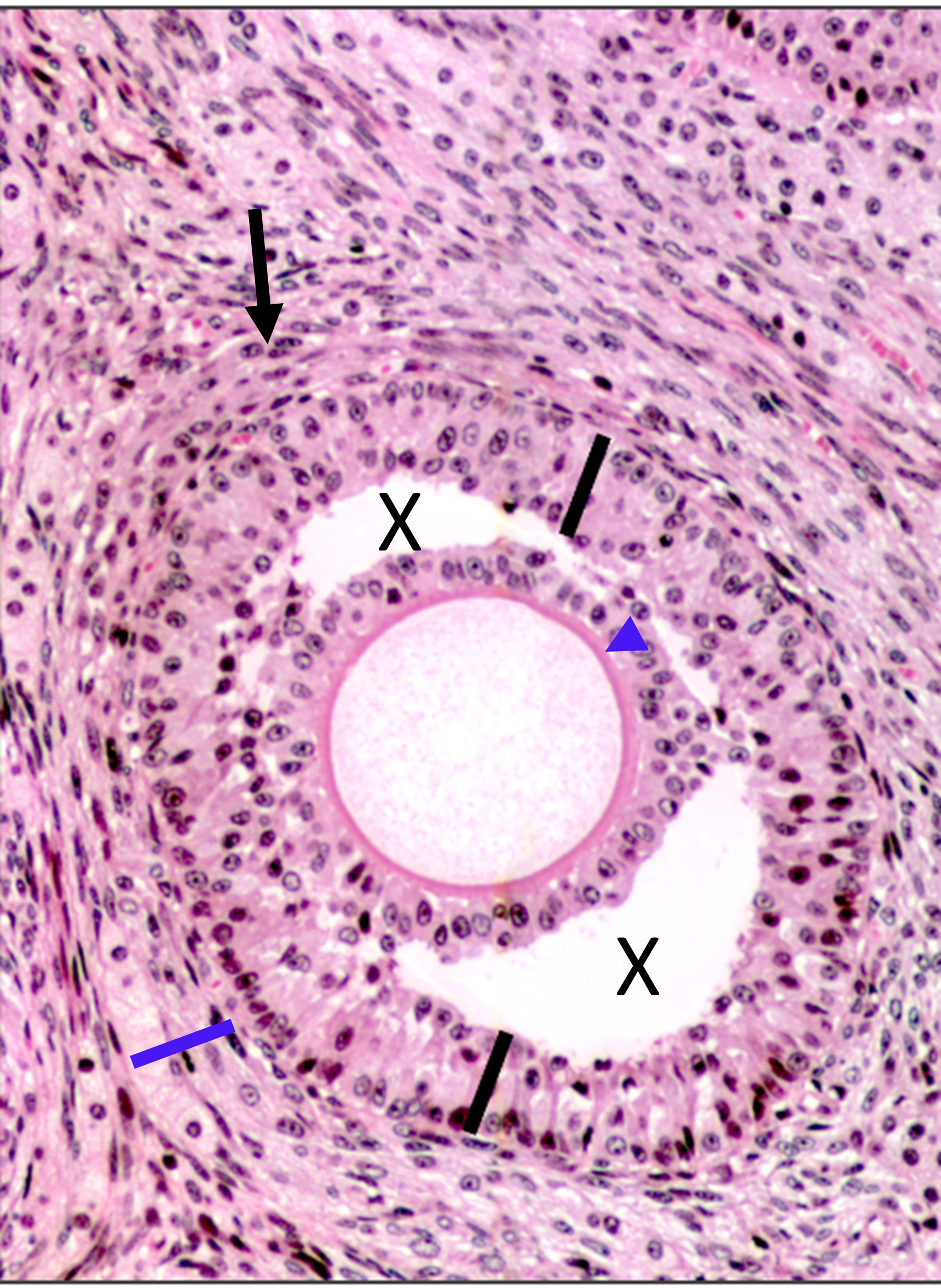 Histology slide of an ovary with structures with arrows, lines, and x's pointing out key areas.