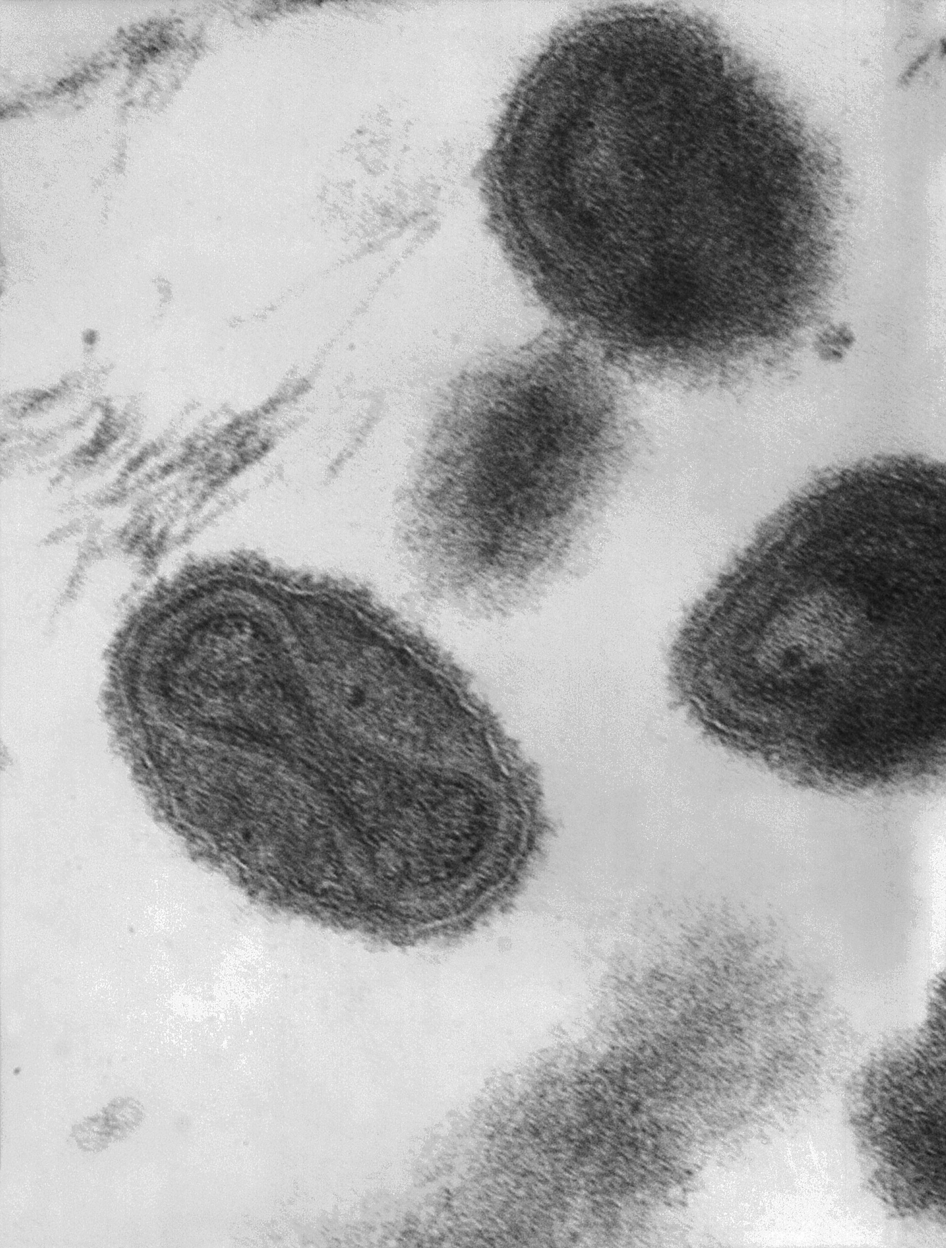 Smallpox_virus_virions_TEM_PHIL_1849-scaled-1.jpeg
