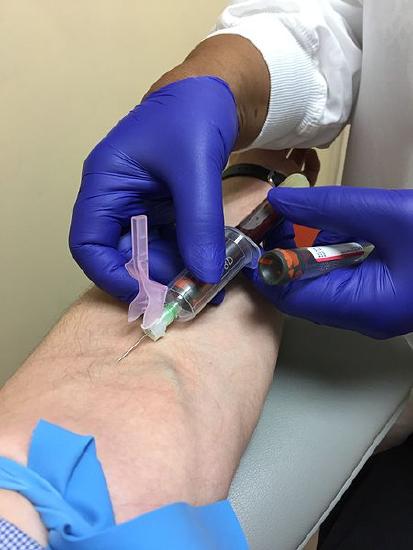 Blood collection from the antecubital vein