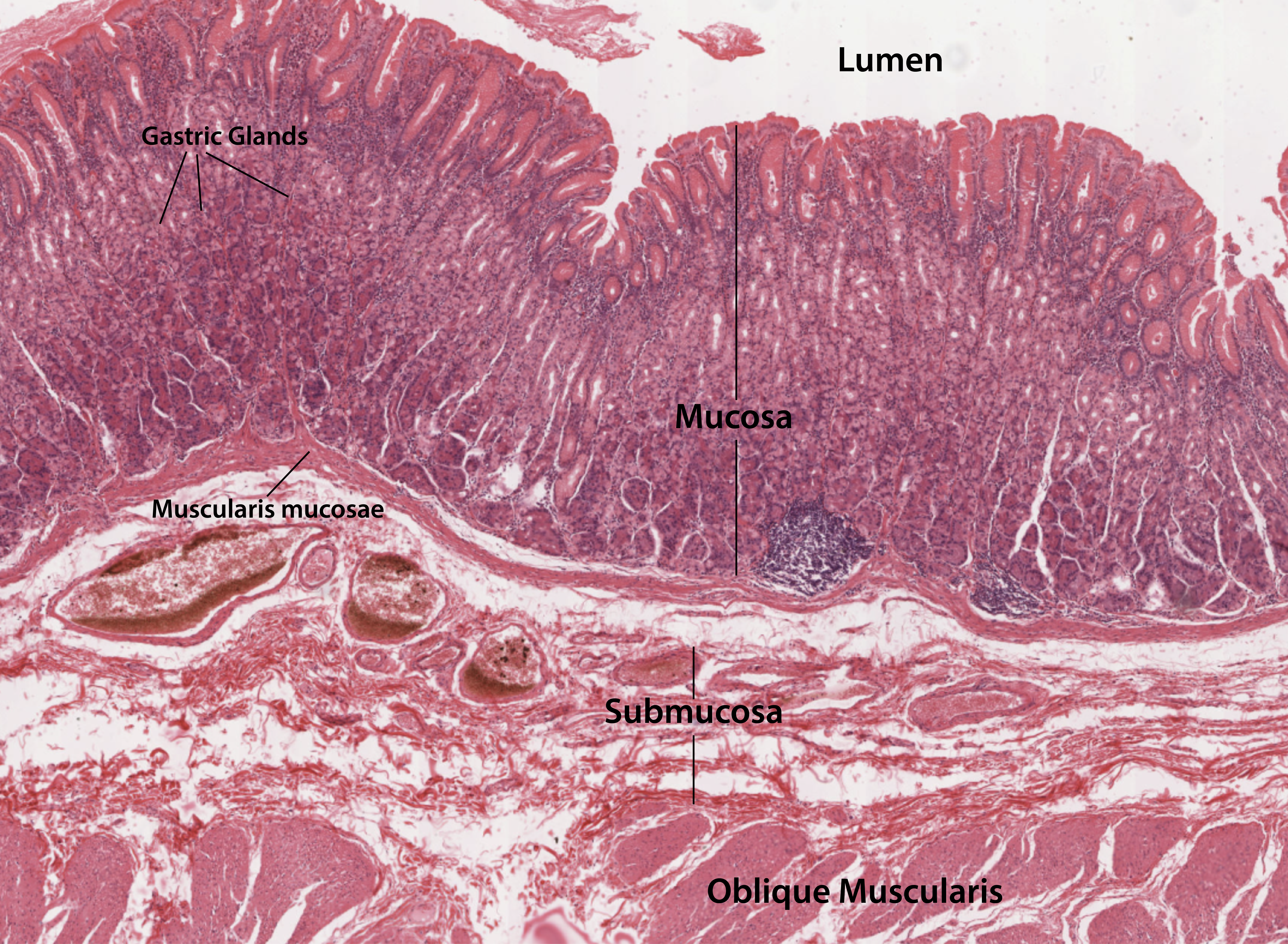 Stomach histology  photograph showing the layers labeled.