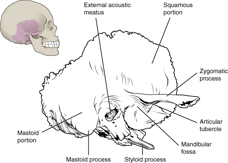 Lateral view of right temporal bone