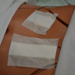 Prepare patient and expose wound