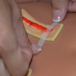 Cut Steri-Strips to allow them to extend 1.5 to 2 cm on each side of incision