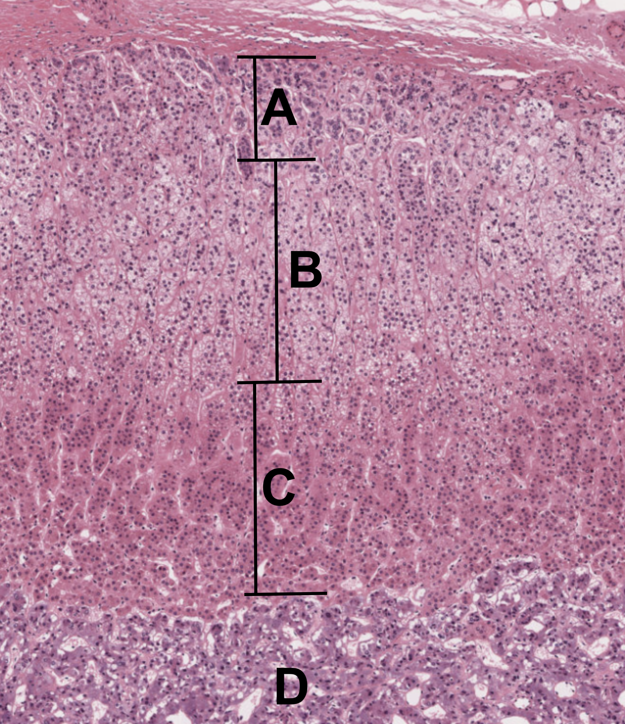 Micrograph of the different parts of the adrenal gland.
