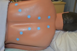 Auscultate posterior chest. Blue dots indicate stethoscope placement for auscultation