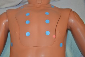 Auscultate anterior chest. Blue dots indicate stethoscope placement for auscultation