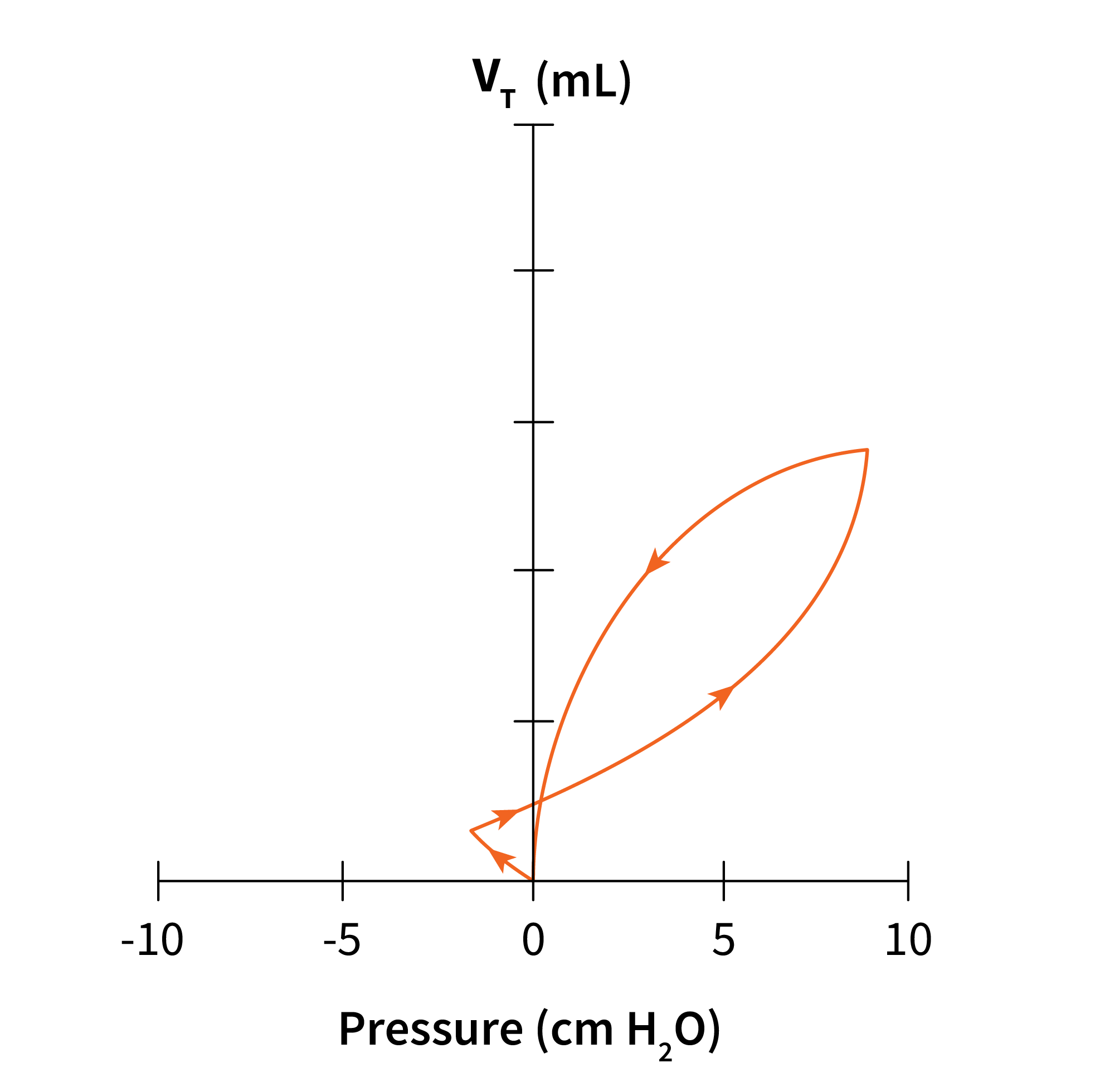 PV Loop for an Assisted Breath.
