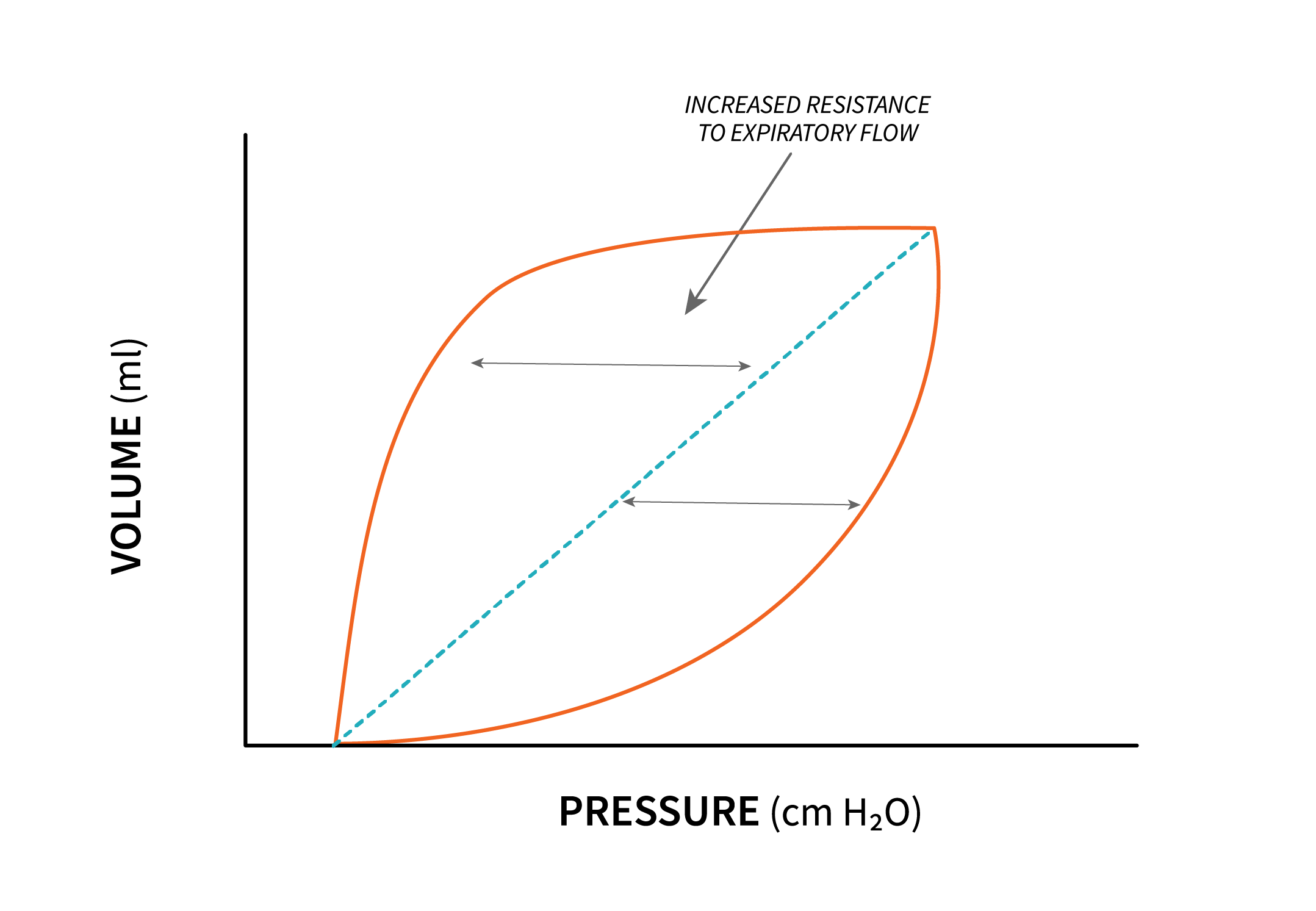 PV Loop - Increased Inspiratory Resistance