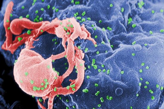 Scanning electron micrograph of HIV-1 budding on a lymphocyte. 