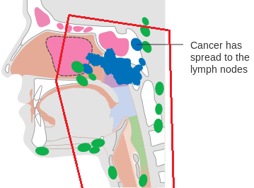 The general field borders for treatments of the nasopharynx.