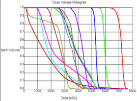 DVH for a cancer of the nasopharynx.
