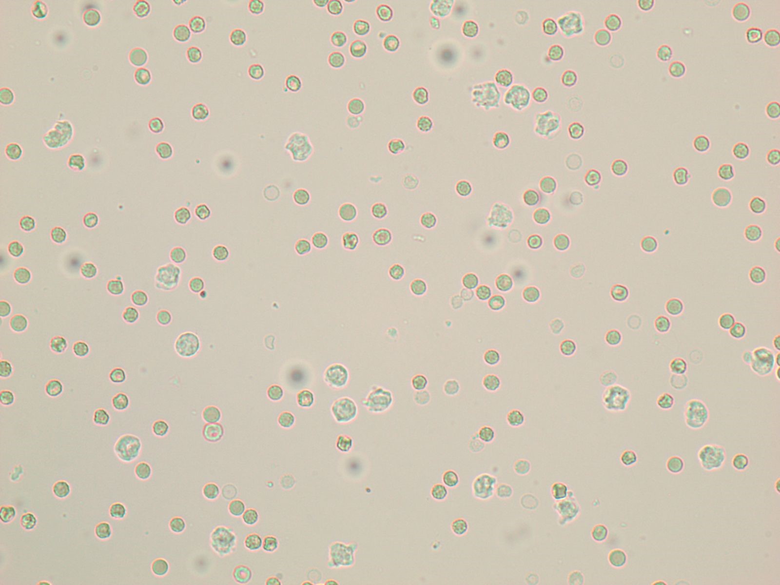 8 Rbcs 8.4: Common Structures Observed on the Sediment Exam - Medicine LibreTexts