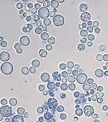 Prototheca wet mount with several of the &ldquo;floral&rdquo; morphology