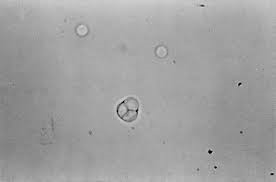 Prototheca wet mount with several of the Mercedes-Benz morphology