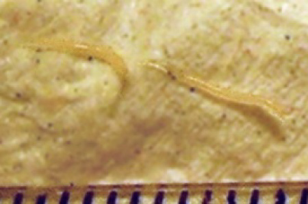 A photograph of a pinworm.