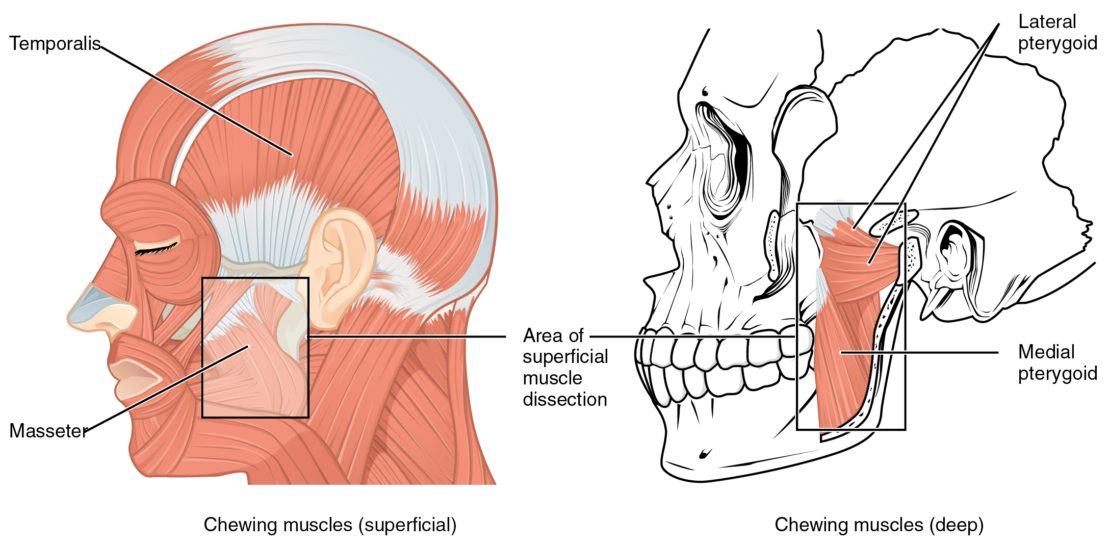 Lateral view of head showing superficial muscles and lateral view of skull showing chewing muscles