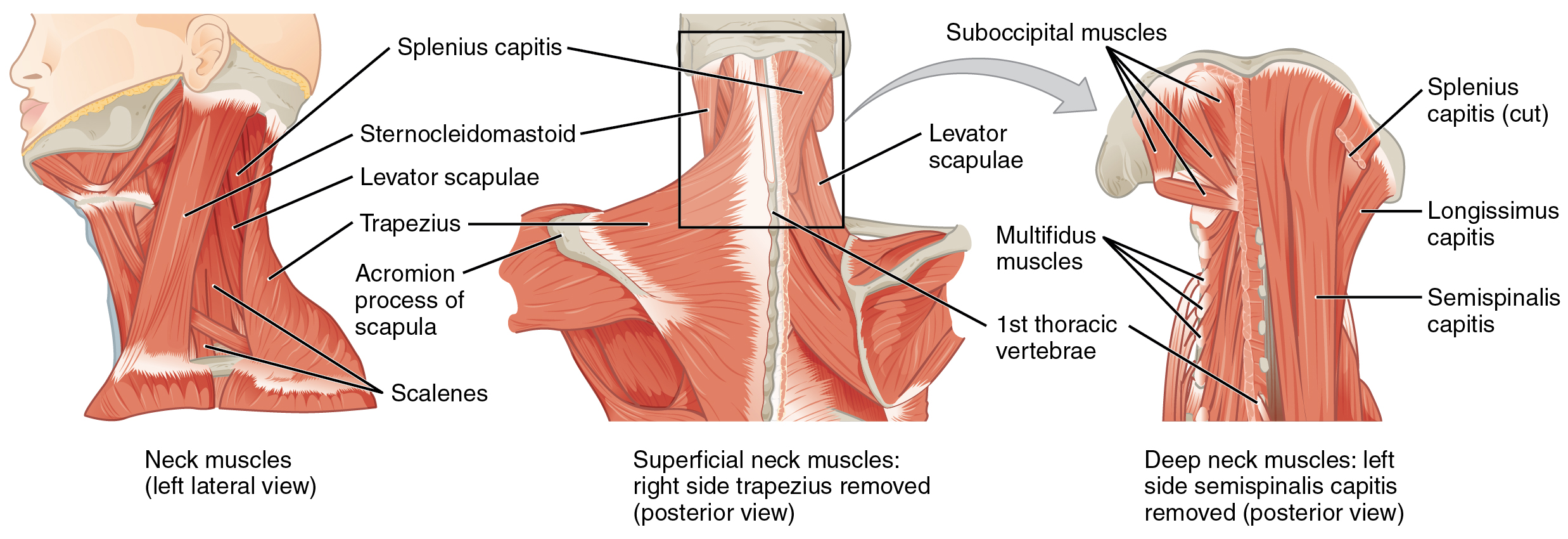 Lateral and posterior views of superficial muscles of the neck; posterior view of deep muscles of the neck.