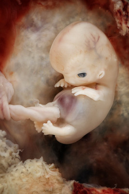 Embryo at 7-8 weeks