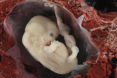 Embryo 6-7 weeks.jpg