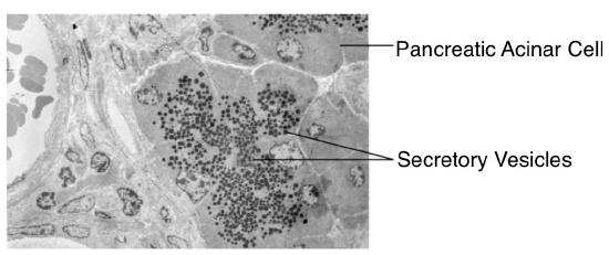 Pancreatic acinar cells filled with vessicles.n the lighter cellular background.