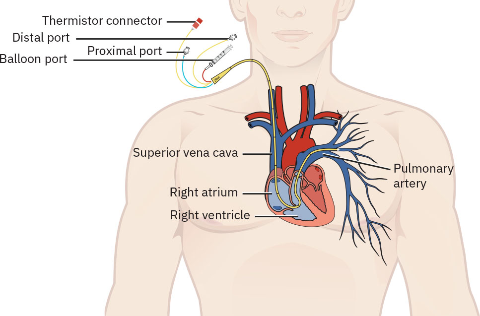 35.2: Cardiovascular Concerns - Medicine LibreTexts