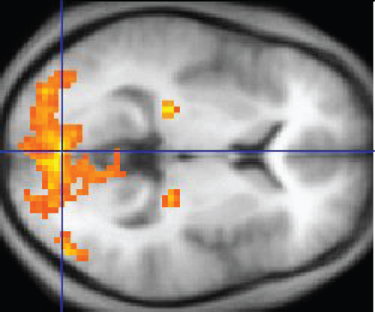 fMRI image of brain showing activity in the occipital lobe.