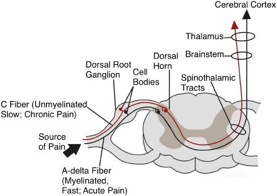 Diagram of the pain pathway showing C fibers and A-delta fibers transmitting signals from a pain source through the dorsal root ganglion, dorsal horn, and brainstem to the cerebral cortex.
