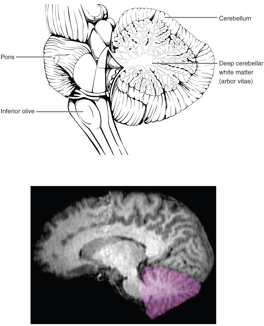 Cerebellum is shaped like an horizontal tree, growing from the pons.