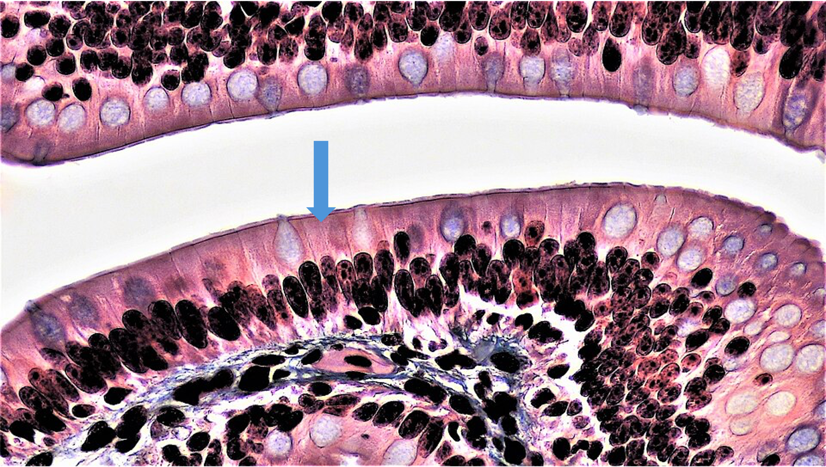 Microscopic view of epithelial tissue, showing layers of cells with a blue arrow indicating a specific cell.