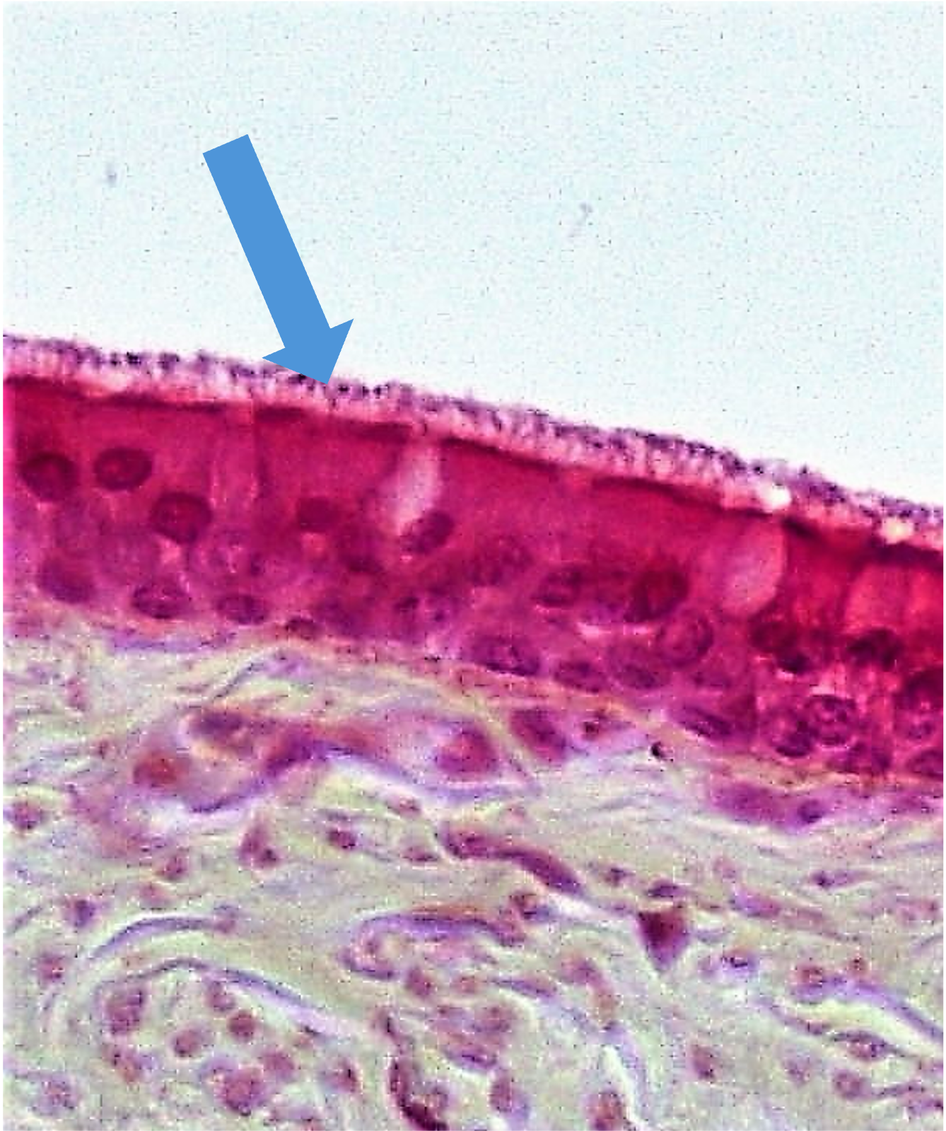 Microscopic view of skin tissue showing layered cells, with an arrow pointing to the upper layer.