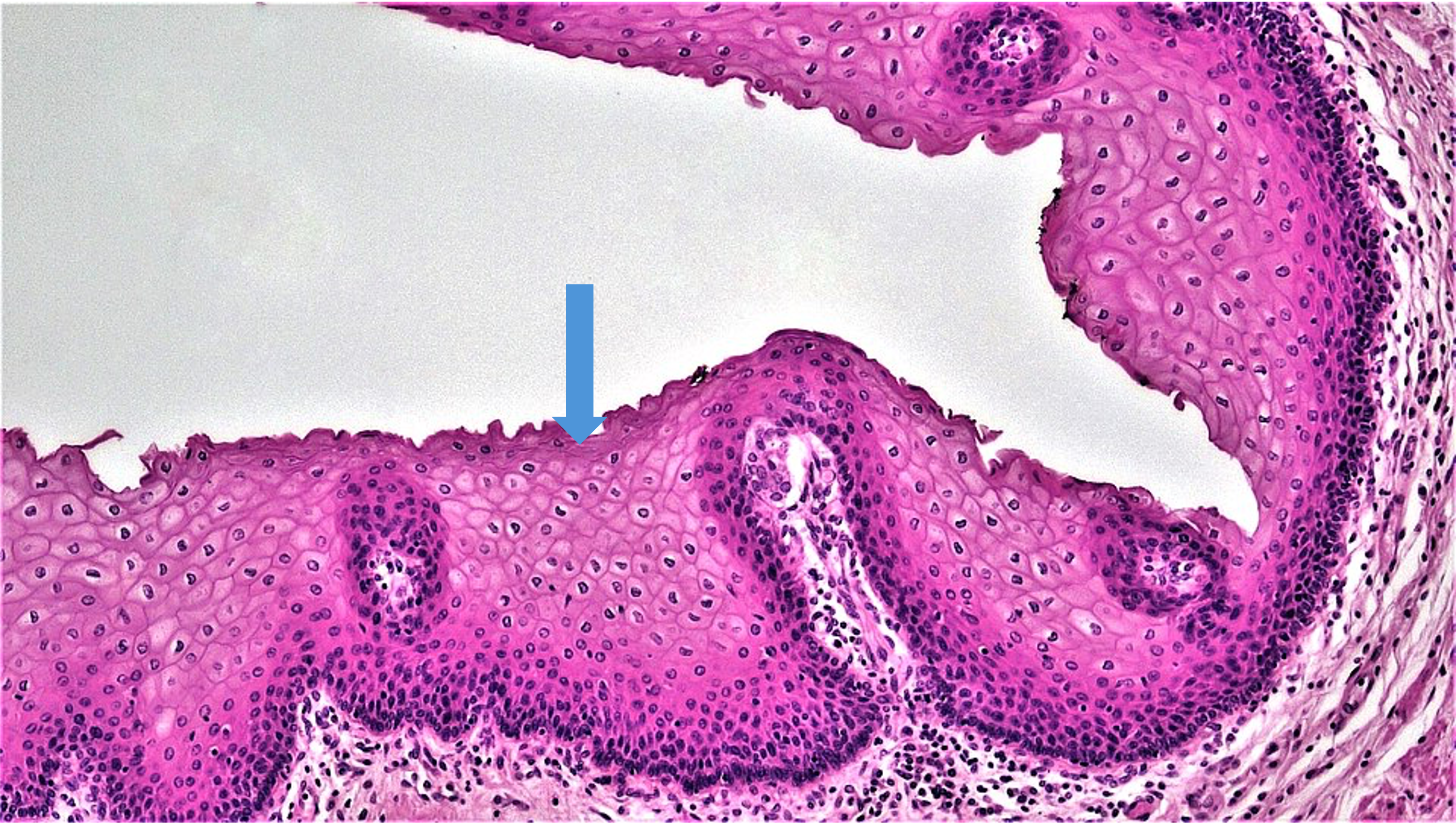 Microscopic view of tissue showing layers of cells, stained pink and purple, with an arrow pointing to a specific area.