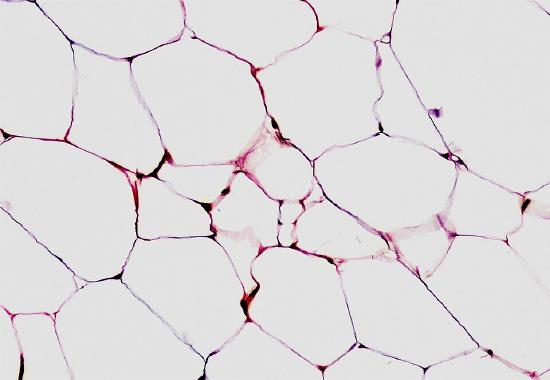 ConnectiveTissue3.jpg
