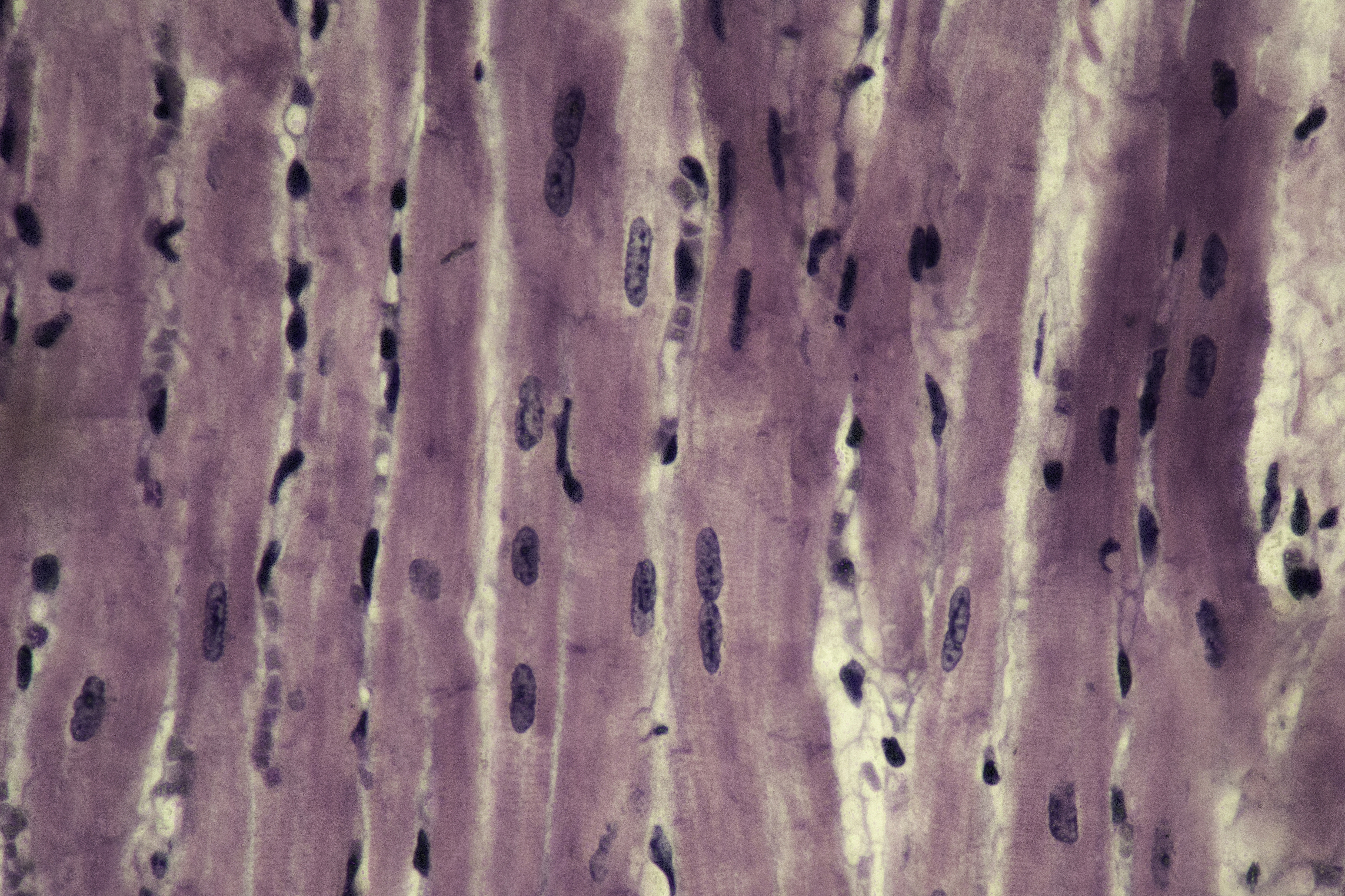 Microscopic view of tissue featuring elongated cells with dark nuclei against a light purple background.