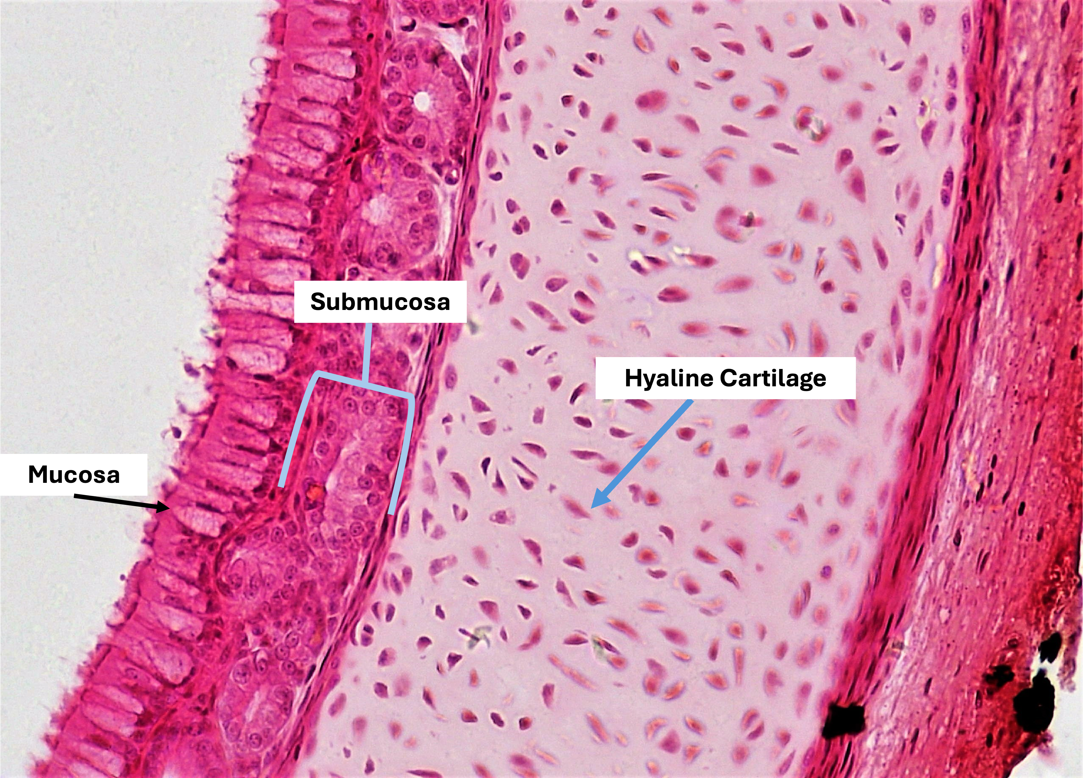 Microscopic view showing mucosa, submucosa, and hyaline cartilage, highlighted in pink with labeled areas.