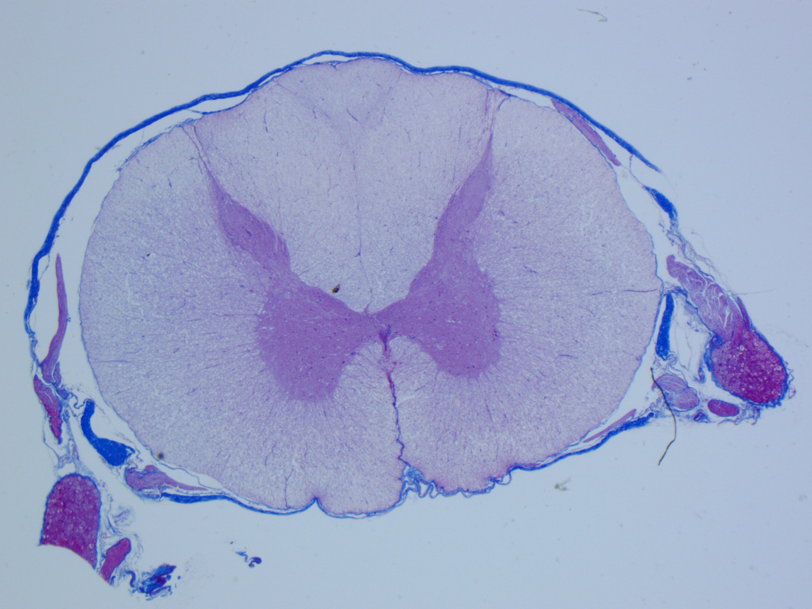 Spinal Microscope 8.7: Microscope Slides - Brain and Spinal Cord - Medicine LibreTexts