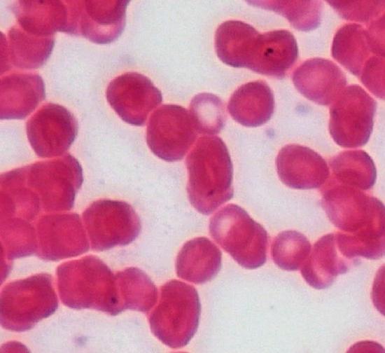Krizocyte Rbc 13.2: Erythrocytes - Medicine LibreTexts