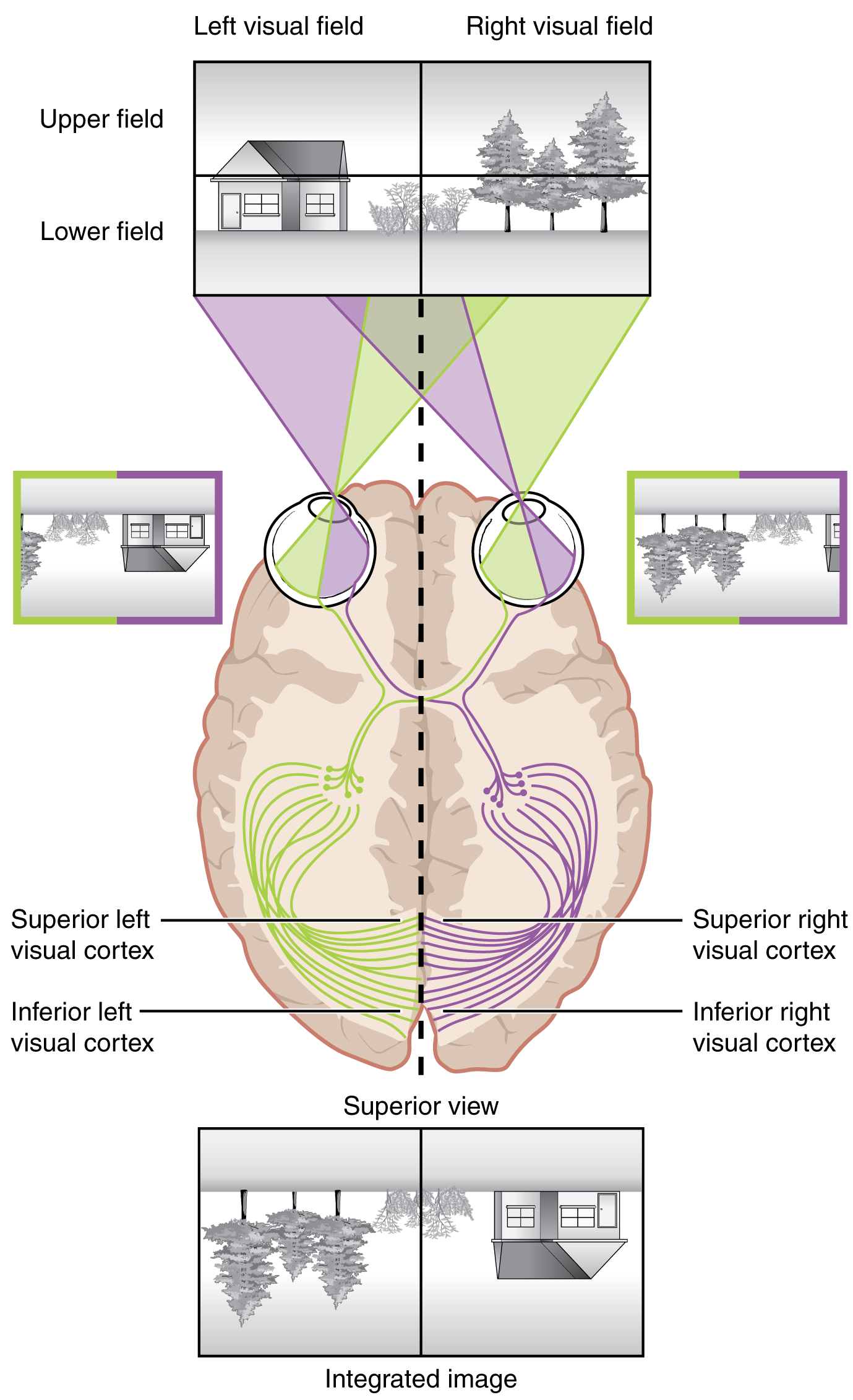 Image divided into the visual fields and shows as projected in the retina and visual cortex