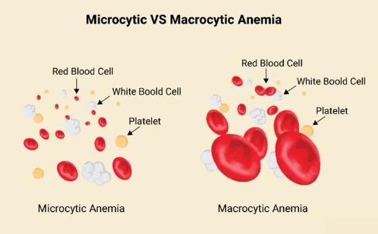 Microcytic Rbc Size 11.3: Nutrients Important in Blood Function - Medicine LibreTexts